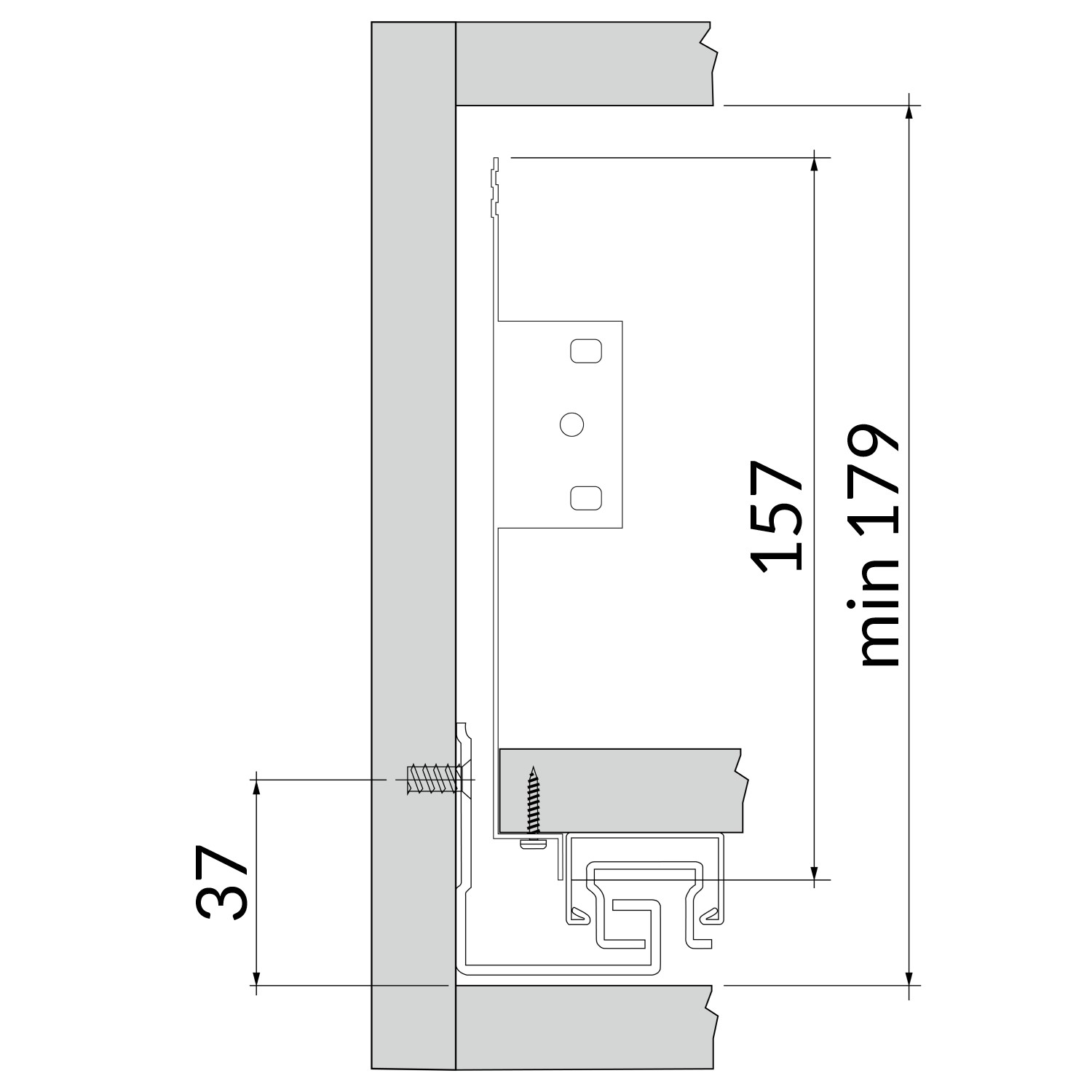 implantation avant