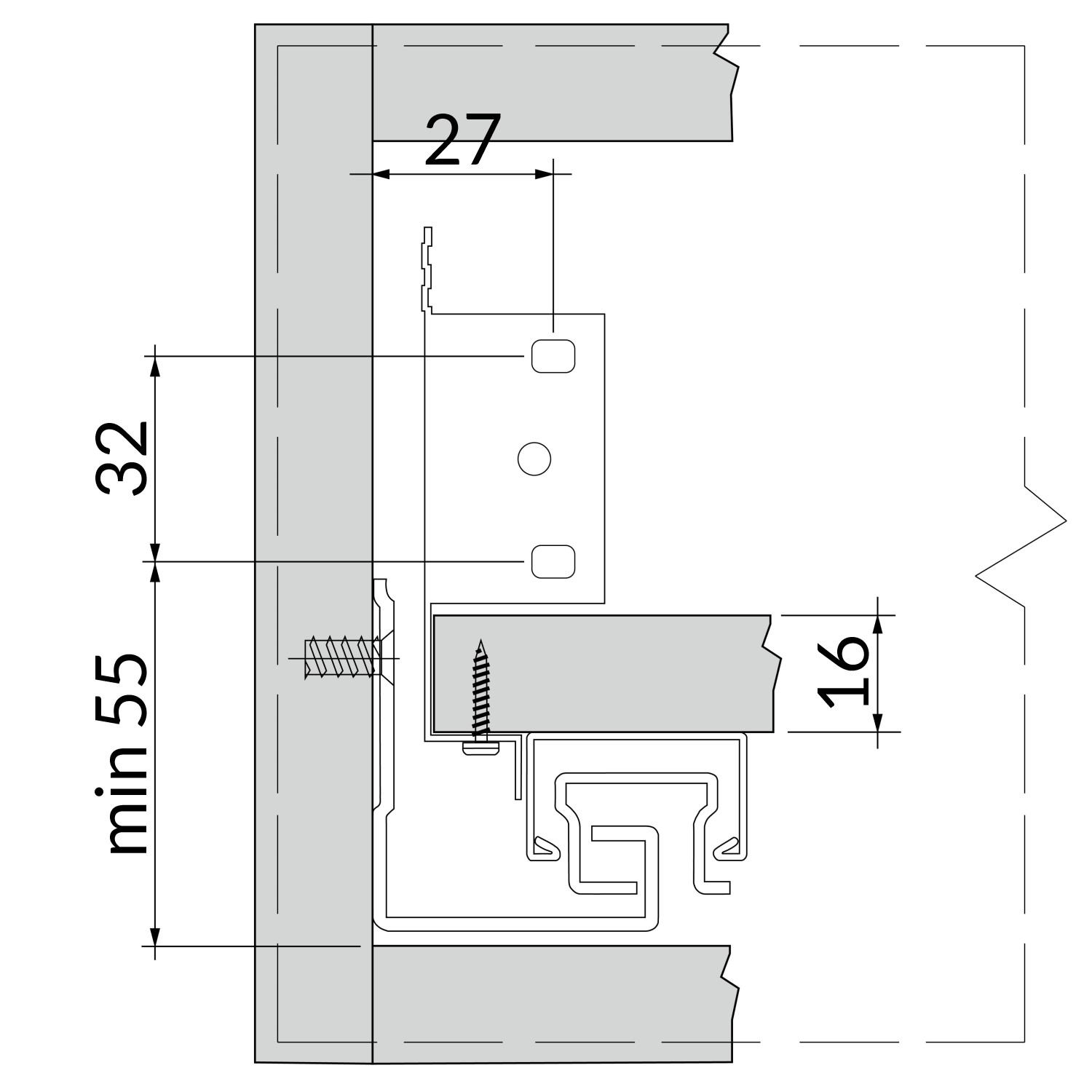 implantation façade